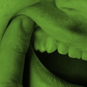 Ból zęba, infekcja zęba - jakie są powody i skutki?