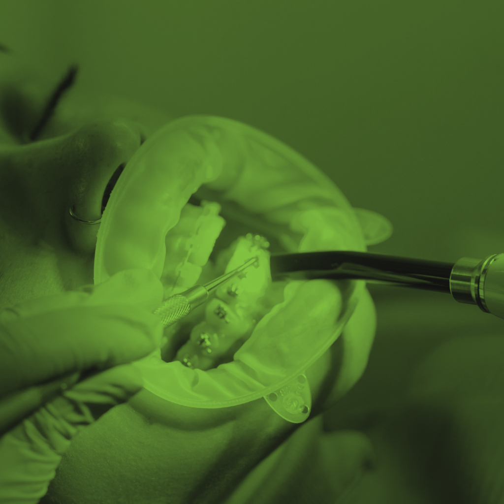 Co to jest aparat ortodontyczny?