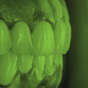 resekcja zęba rekonwalescencja ALBUSDENT - Centrum Stomatologiczne